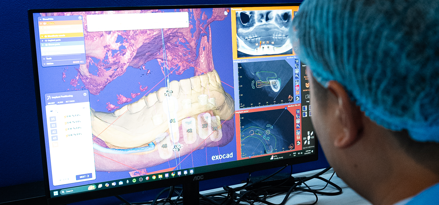 Bucad Vision and Smile Rehab