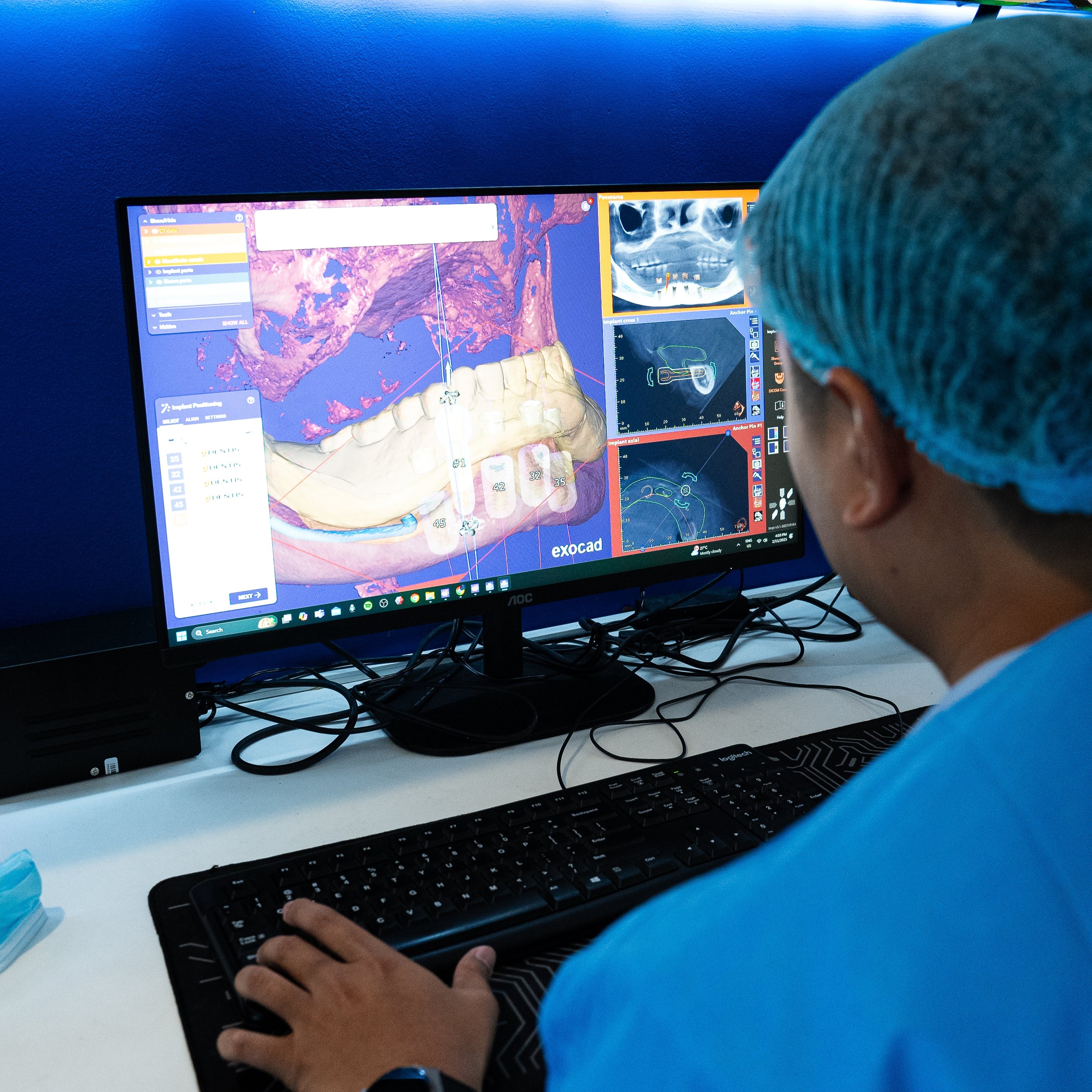 5-Minute Dental Implant