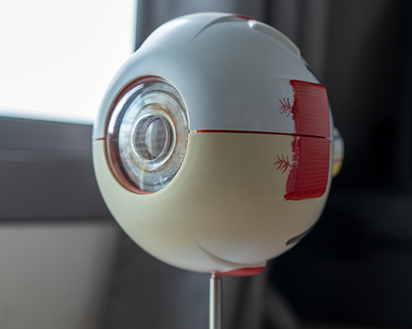 Prosthetic Eye